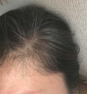 ハニーブロンド染める前の画像